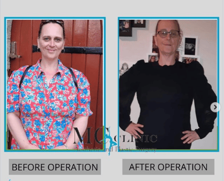 Slider image (6) MEHMET CEBER CLINIC